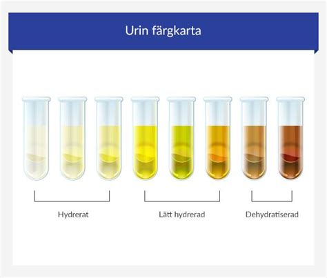 Dansk urin